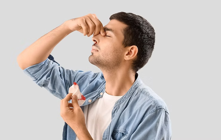 Ilustração de sangramento nasal (epistaxe) em consulta de otorrinolaringologia