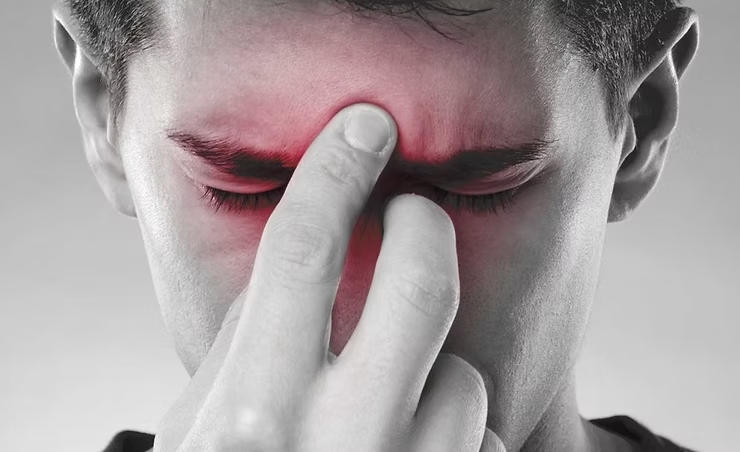 Ilustração dos seios da face inflamados, região afetada pela sinusite
